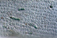 Enteromorpha