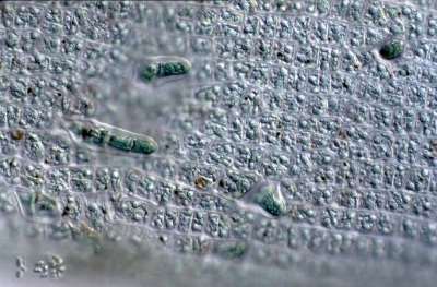 Enteromorpha intestinalis