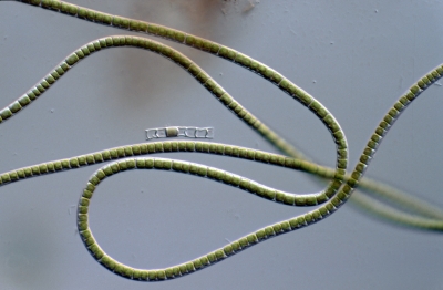 Microspora quadrata