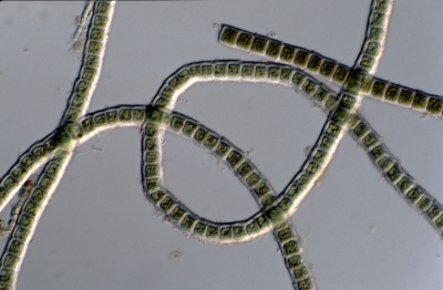Microspora lauterbotnii