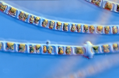 Microspora spec.