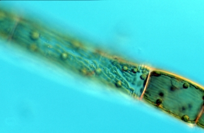 Oedogonium