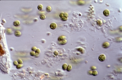 Palmellopsis gelatinosa