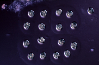 Palmellopsis gelatinosa