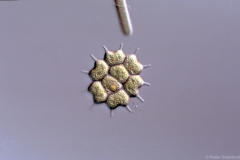Pediastrum
