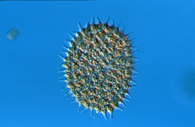Pediastrum boryanum