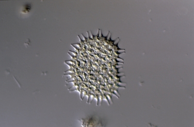Pediastrum boryanum