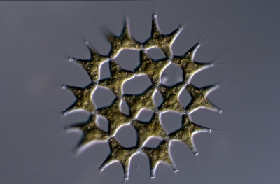 Pediastrum gracillimum