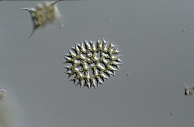 Pediastrum biradiatum