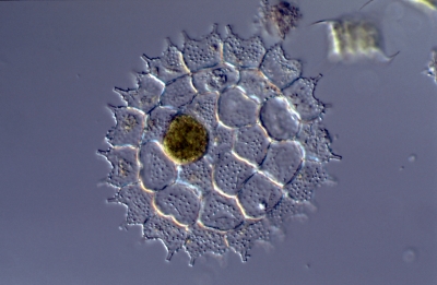 Pediastrum boryanum