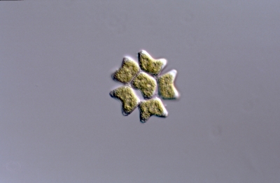 Pediastrum