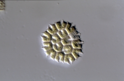 Pediastrum tetras