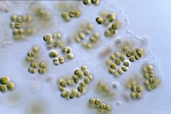 Pseudosphaerocystis