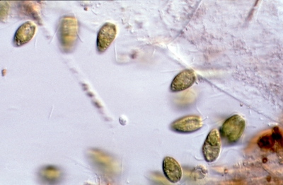 Pyramimonas spec.