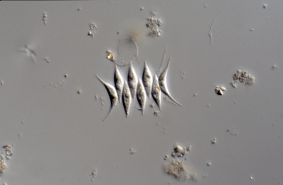 Scenedesmus dimorphus