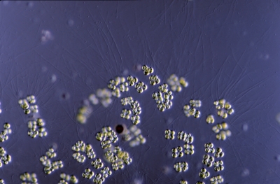 Tetraspora gelatinosa