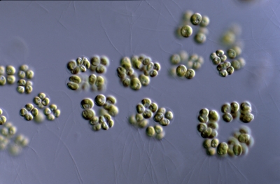 Tetraspora gelatinosa