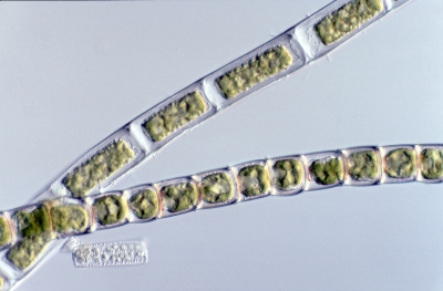 Ulothrix spec.