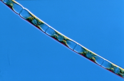 Ulothrix spec.