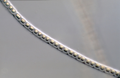 Urospora?