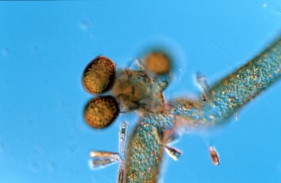 Vaucheria verticillata