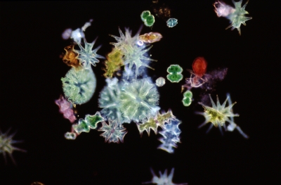 Bunte Mischung Mucikarmin, Alizarinviridin-Chromalaun, Chrysoidin, Bismarck-Braun Bunte Mischung Mucikarmin, Alizarinviridin-Chromalaun, Chrysoidin, Bismarck-Braun