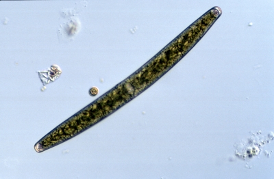 Closterium baillyanum