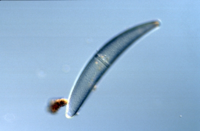 Closterium costatum