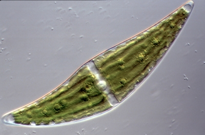 Closterium ehrenbergii