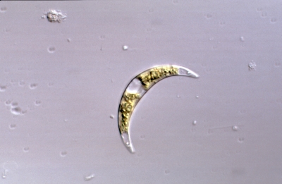 Closterium incurvum