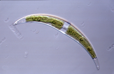 Closterium leibleinii