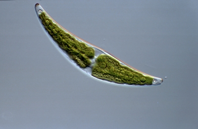 Closterium moniliferum
