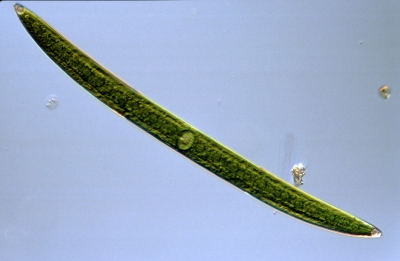 Closterium turgidum