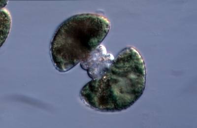 Cosmarium botrytis