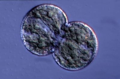 Cosmarium dentatum