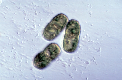 Cosmarium elegantissimum