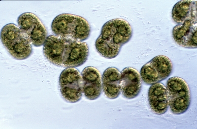Cosmarium margaritatum