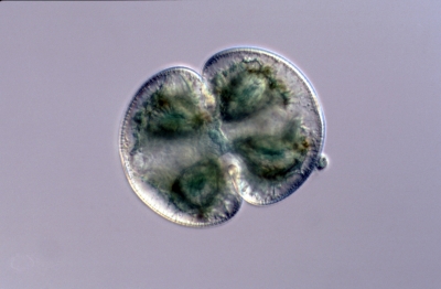 Cosmarium pachydermum