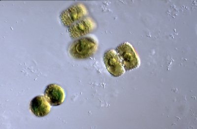 Cosmarium punctu latum