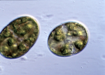 Cosmarium subturgridum