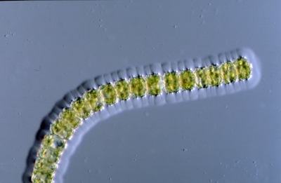 Desmidium cylindricum