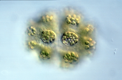 Euastrum prowsei Euastrum prowsei