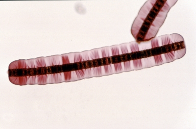 Hyalotheca dissiliens