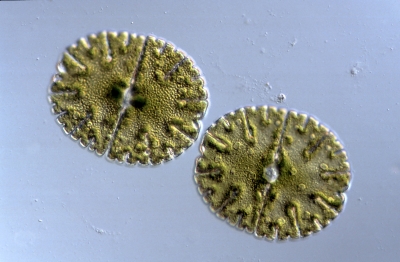 Micrasterias denticulata