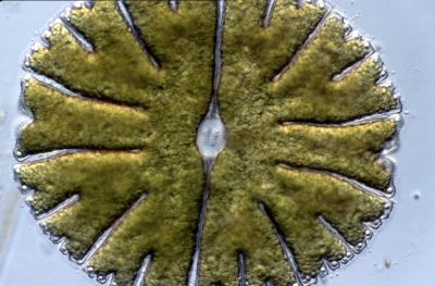 Micrasterias denticulata