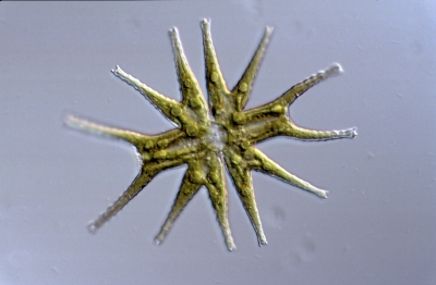 Micrasterias hardyi