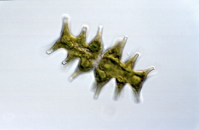 Micrasterias muricata