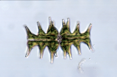 Micrasterias muricata