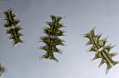 Micrasterias muricata