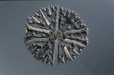 Micrasterias papillifera